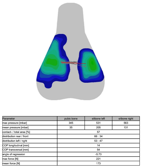 A visual output of saddle pressure mapping