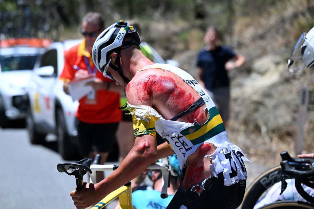 Luke Plapp (Jayco-AlUla) suffered lots of road rash after his crash during stage 3 of the Tour Down Under