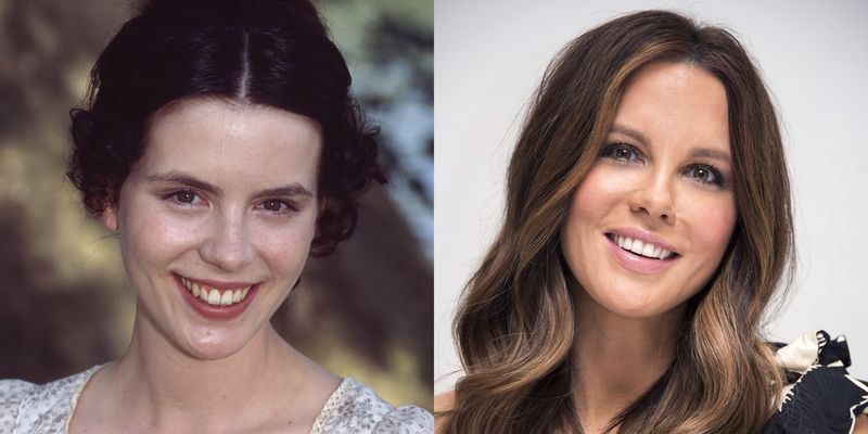 Celebrity Smiles Before And Afters - Celebrity Dental Work | Marie Claire