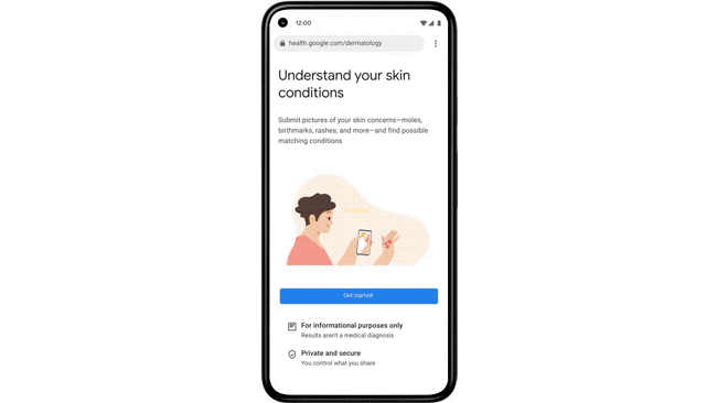 Google AI dermatology tool
