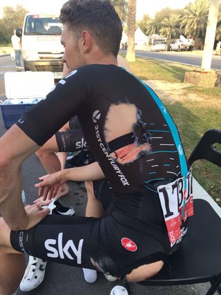 The results of the stage 1 crash at the Abu Dhabi Tour for Owain Doull