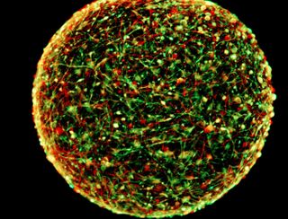 A mini-brain, from the Johns Hopkins lab.