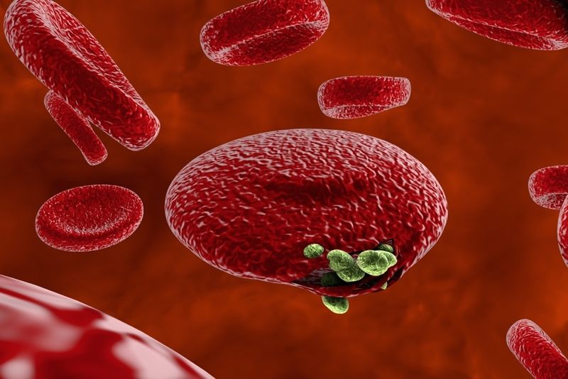 A red blood cell is infected with malaria parasites in the genus Plasmodium.