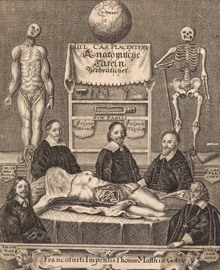 Anatomists around a cadaver