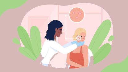 An illustration of a woman and a doctor looking into skincare for PCOS and acne 