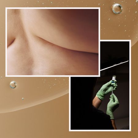 a close-up of bare skin and a pair of hands wearing green gloves filling a needle on a golden tan background