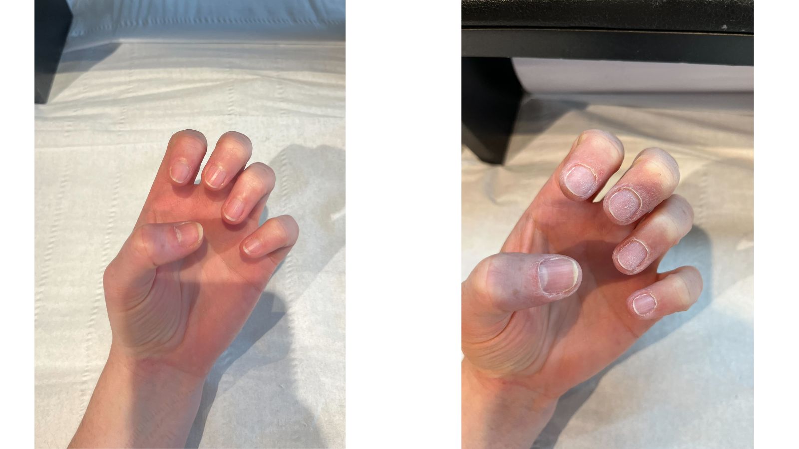 An image of our beauty writer's nails before (L) and after (R) 45 minutes of cuticle care during a Japanese manicure