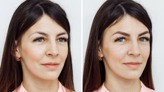 A woman before and after having her eyebrows microbladed