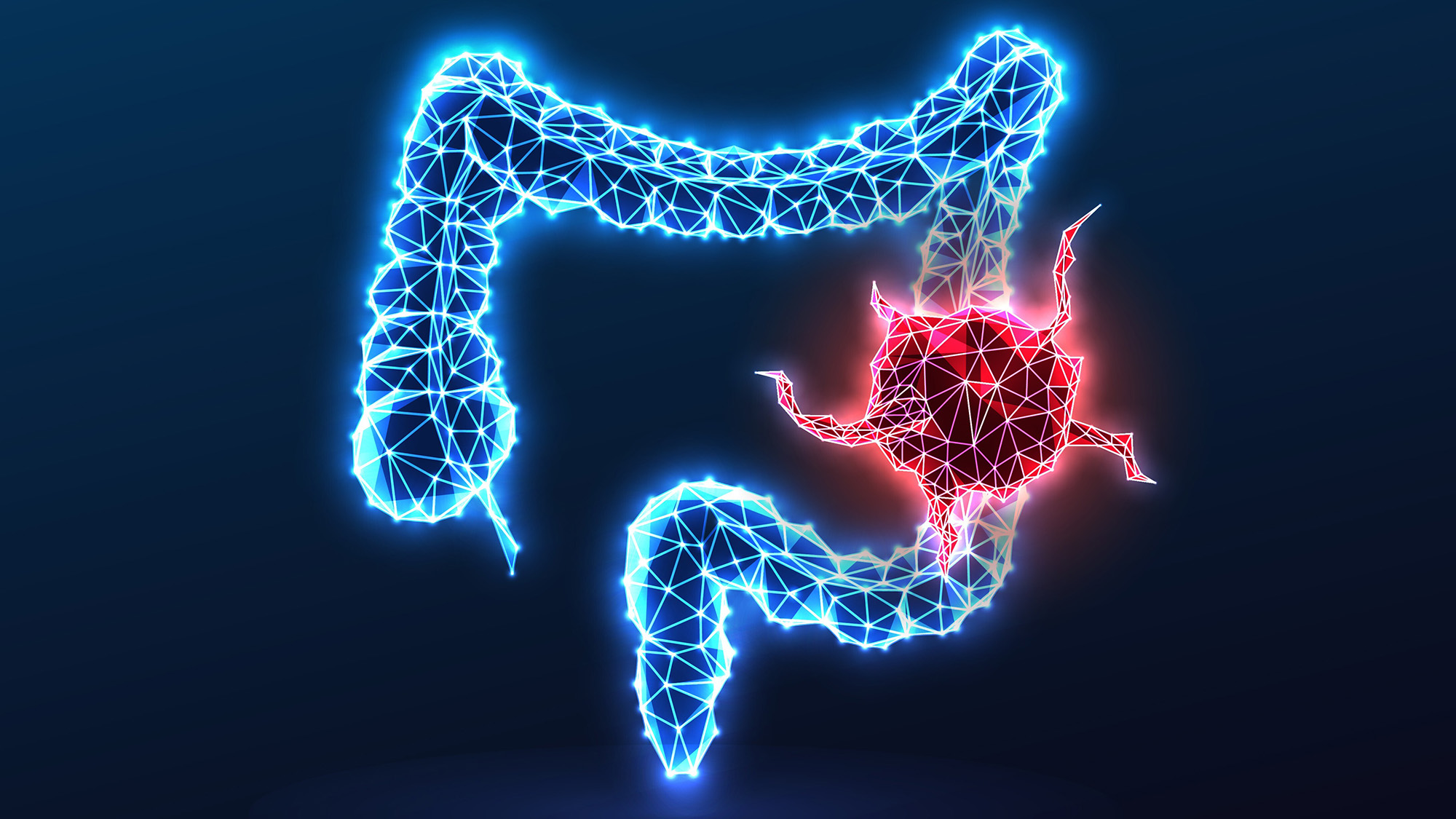 An illustration of the intestinal system with a large spiky red orb on the right side.
