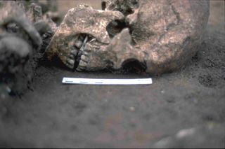 The man's skeleton was found with a flat stone in his mouth, and a new study indicates that his tongue may have been amputated when the man was alive. 