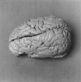broca-brain