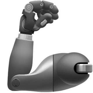 prosthetic arm
