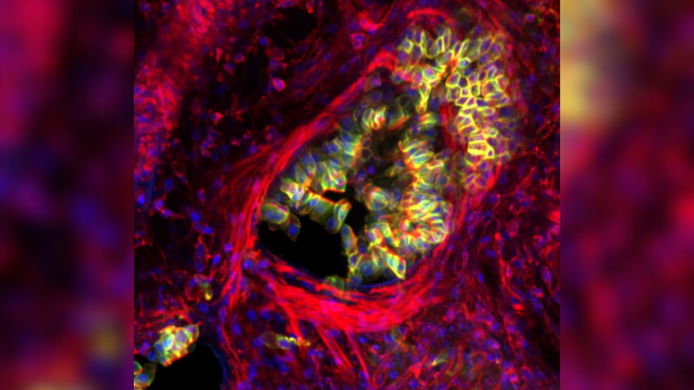 Multi-colored microscope image showing airway epithelial cells squeezing out of the airways