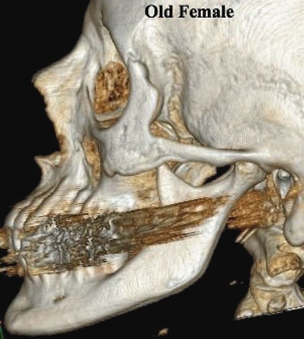 Your Facial Bone Structure Has a Big Influence on How People See