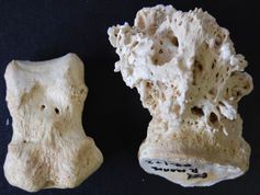 Normal (left) and badly diseased (right) elephant toe bones.