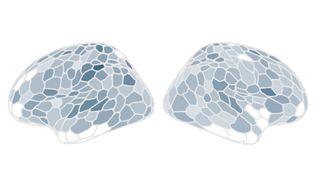 Two stylized images showing the amount of gray matter in the brain.