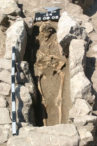 The first evidence of sepsis during pregnancy was found in this 800-year-old skeleton of a woman who lived on the outskirts of the ancient city of Troy in modern Turkey. 