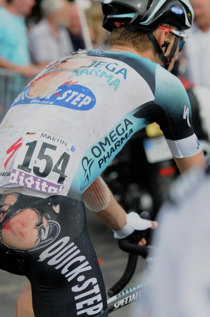 Tony Martin's back showed the full extrent of the damage, with much of his clothing shredded by the crash