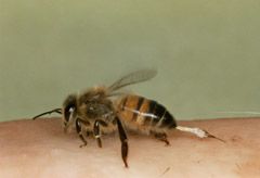 Bee Sting (LL)