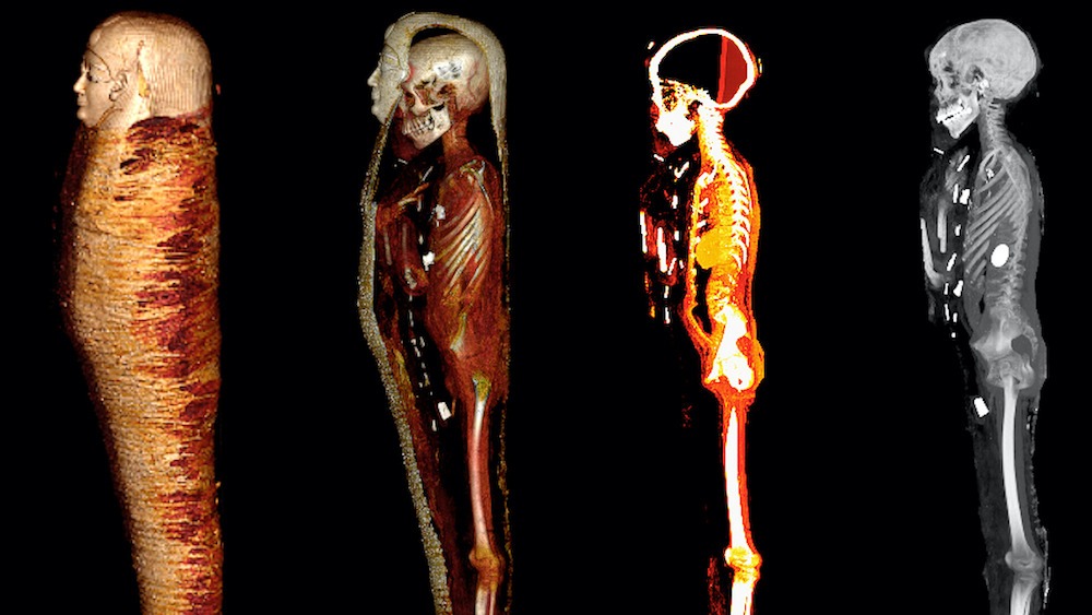 A series of images, including CT scans of a mummy.