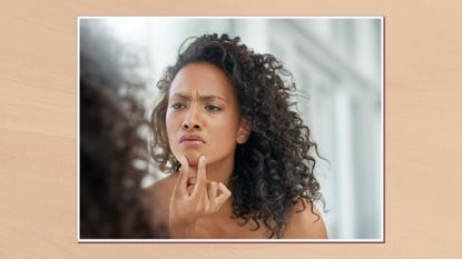 Image of woman squeezing chin in a white frame against a peach watercolour-style background