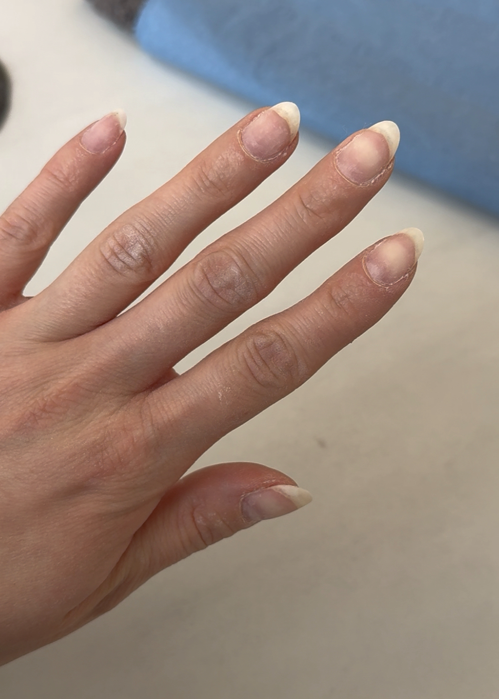 Lucy's nails before IBX application