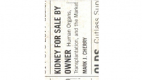 Kidney For Sale By Owner
