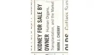 Kidney For Sale By Owner