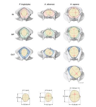 An illustration of how primates give birth. Left: Chimpanzee newborns (top to bottom) do not rotate as they exit the birth canal. Right: Human newborns (top to bottom) rotate as they exit the birth canal. Middle: Researchers think Australopithecus afarensis newborns (top to bottom) rotated a bit as they exited the birth canal, but not as much as human infants do.