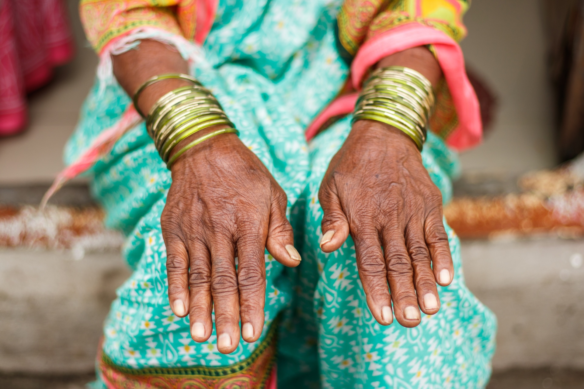 a close-up of a woman's weathered hands