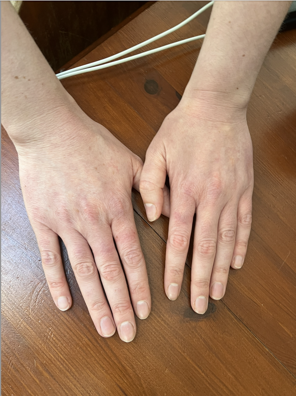 A photo of Sophie's hands