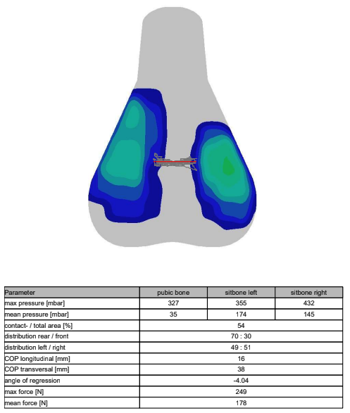 A visual output of saddle pressure mapping