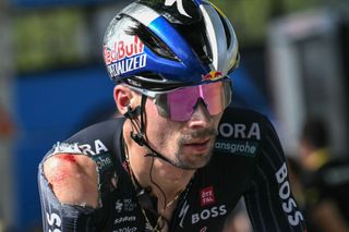 Red Bull - BORA - hansgrohe team's Slovenian rider Primoz Roglic, with visible injuries sustained in a crash in the final kilometers of the stage, cycles past the finish line of the 12th stage of the 111th edition of the Tour de France cycling race, 203,6 km between Aurillac and Villeneuve-sur-Lot, southwestern France, on July 11, 2024. (Photo by Marco BERTORELLO / AFP)