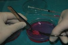 This photograph shows a piece of ovarian tissue in a petri dish before it was frozen and stored for transplantation at a later date.
