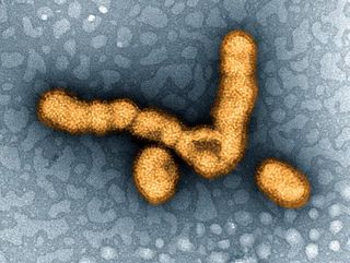 This digitally-colorized image shows the H1N1 influenza virus under a transmission electron microscope. In 2009, this virus (then called the swine flu) caused a pandemic, and is thought to have killed 200,00 people worldwide.
