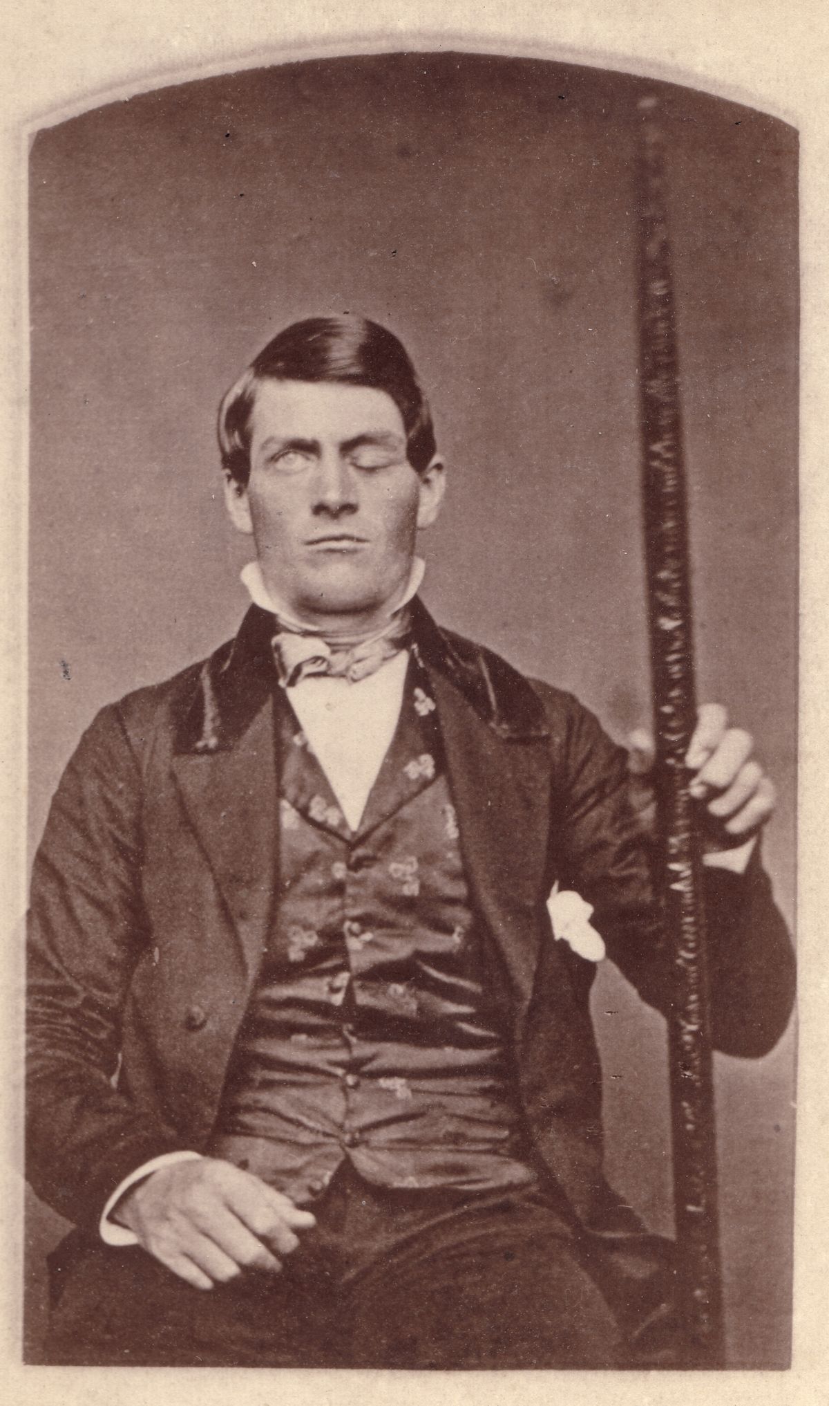 Phineas Gage poses with his &quot;constant companion,&quot; the tamping iron that was removed from his brain.