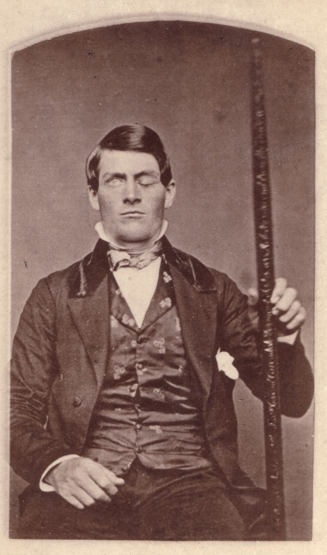How Man Survived a Rod Through His Brain | Phineas Gage | Live Science