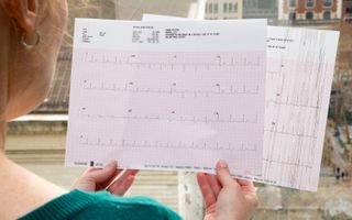 The results of my 12-lead EKG, which came back normal, compared with an EKG I tried to compare against the Apple Watch’s ECG app. The electrical signals caused a noisy reading.