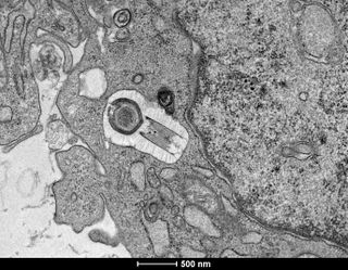 Thin section TEM image of Tupanvirus infecting an amoeba
