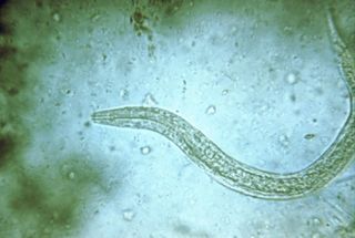 A hookworm, viewed through a microscope.