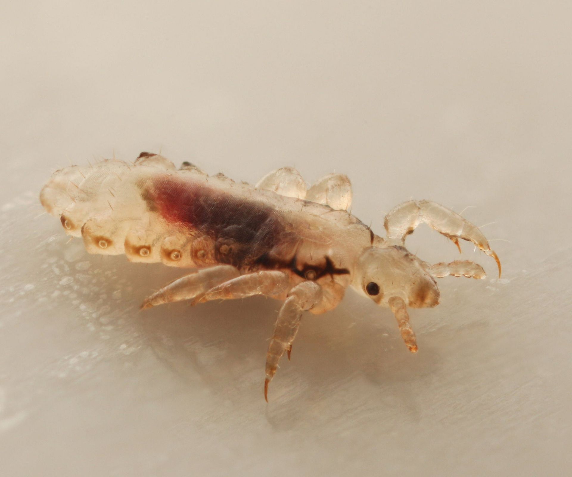 Does vinegar kill lice? Pest control professionals explain Homes & Gardens