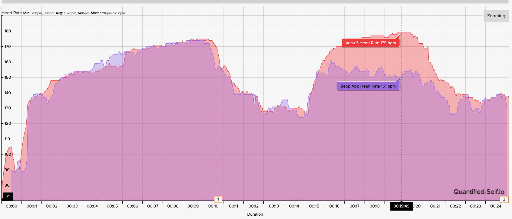 A graph showing how the Amazfit Helio Ring compares to the Garmin Venu 3 for HR accuracy. Amazfit tracks closely at first but falls short in the second half as the runner's HR climbs higher.