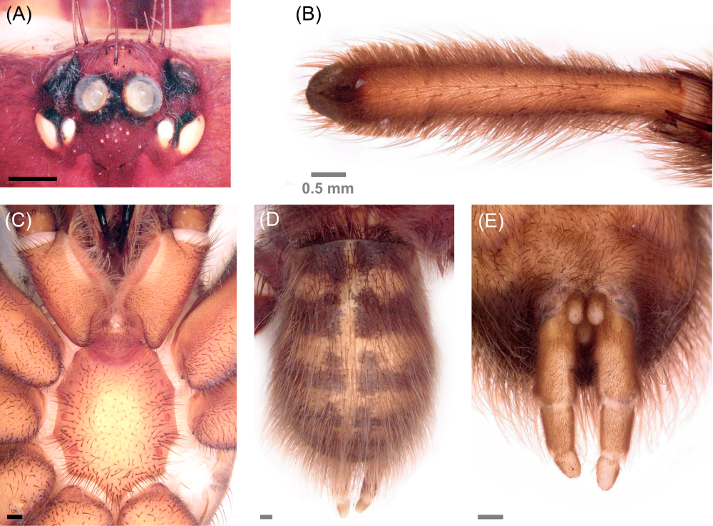 5 photos in a collage showing the spider's fangs, legs, underbody, abdomen and spinnerets.