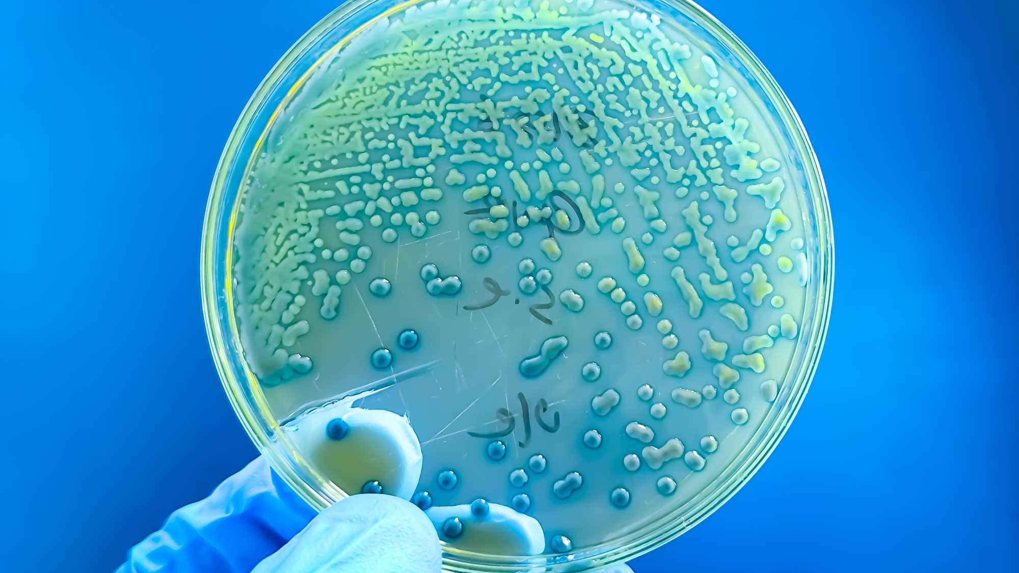 A close up of a latex gloved hand holding a petri dish speckled with dots.