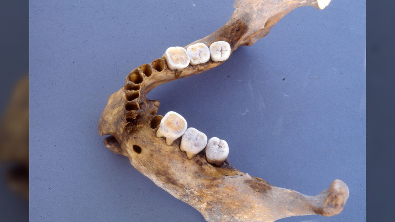 Another view of the warrior's jaw.