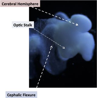 lab-grown Mini-brain