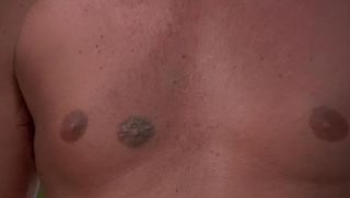 50% Extra Nipple