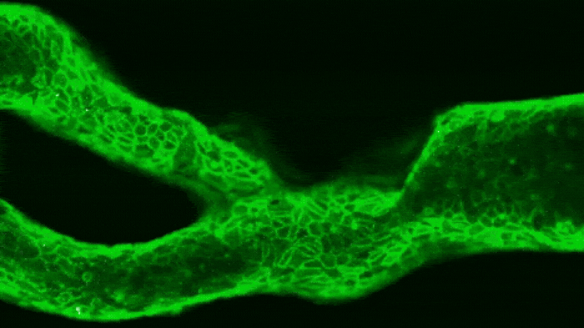 Mini 'arteries-on-a-chip' could help predict a person's risk of stroke