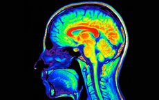 brain scan