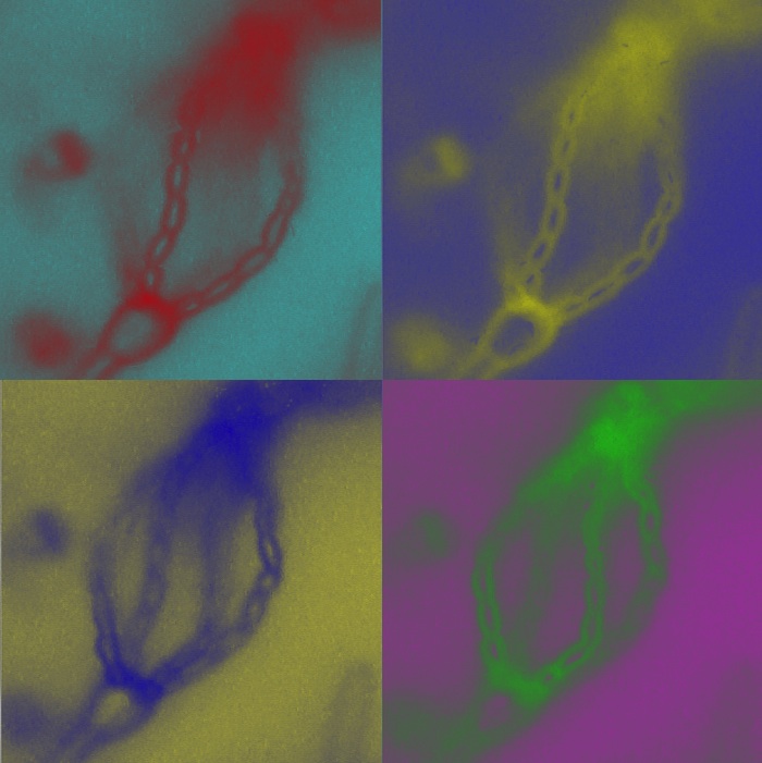 Light microscopy view showing the four chains of infectious spores that decorate the basidium where meiosis occurs and the spores are produced by budding from the apical surface.